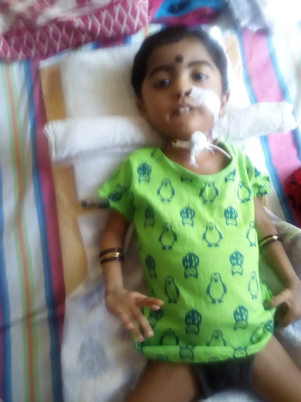 A young child with SMA Type 1